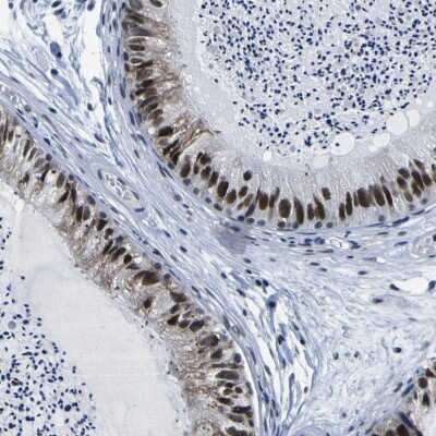 Immunohistochemistry-Paraffin: CUL4B Antibody [NBP1-86099]