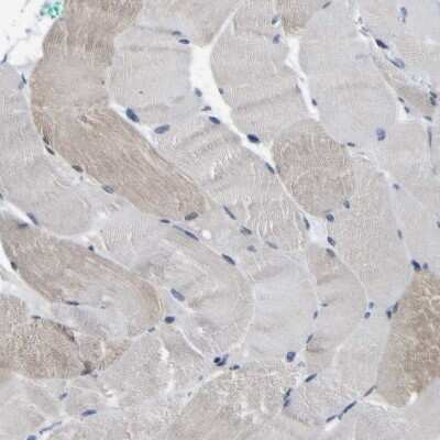 Immunohistochemistry-Paraffin: CUL4B Antibody [NBP1-86099]