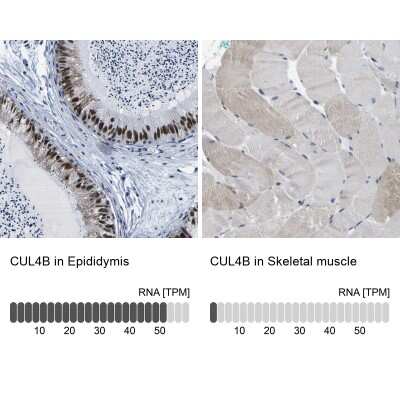 Immunohistochemistry-Paraffin: CUL4B Antibody [NBP1-86099]