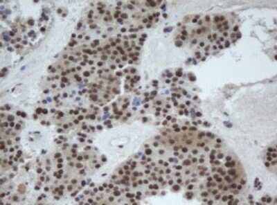 Immunohistochemistry: CUL4B Antibody (OTI1C4) - Azide and BSA Free [NBP2-71373]