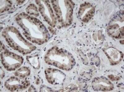 Immunohistochemistry: CUL4B Antibody (OTI1C4) - Azide and BSA Free [NBP2-71373]