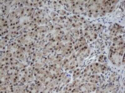 Immunohistochemistry: CUL4B Antibody (OTI1C4) - Azide and BSA Free [NBP2-71373]