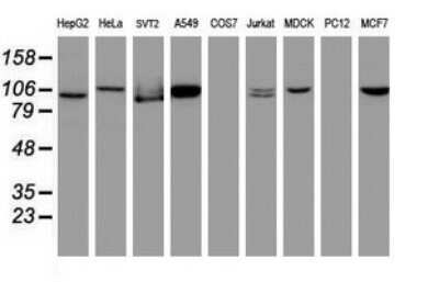 Western Blot: CUL4B Antibody (OTI1C4)Azide and BSA Free [NBP2-71373]