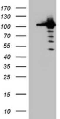 Western Blot: CUL4B Antibody (OTI1C4)Azide and BSA Free [NBP2-71373]