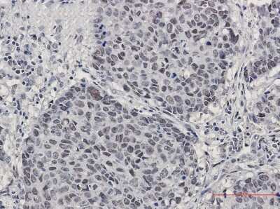 Immunohistochemistry-Paraffin: CUL4B Antibody (S06-3D3) [NBP3-15016]