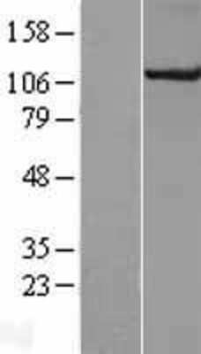 Western Blot: CUL4B Overexpression Lysate [NBL1-09610]