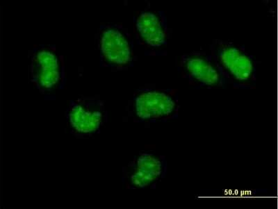 Immunocytochemistry/ Immunofluorescence: CUTC Antibody [H00051076-B01P]