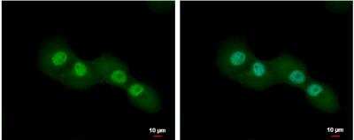 Immunocytochemistry/ Immunofluorescence: CUTC Antibody [NBP2-16038]