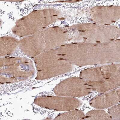 Immunohistochemistry-Paraffin: CUTC Antibody [NBP1-84512]
