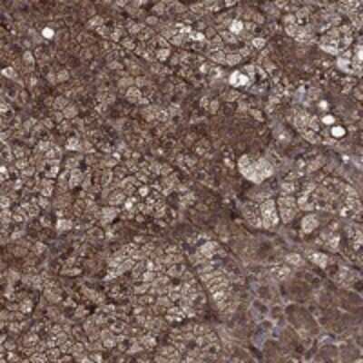 Immunohistochemistry-Paraffin: CUTC Antibody [NBP3-17827]