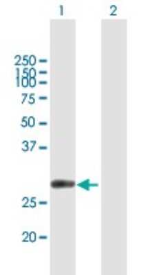 Western Blot: CUTC Antibody [H00051076-B01P]