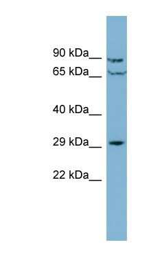 Western Blot: CUTC Antibody [NBP1-56858]