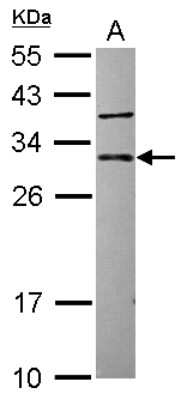 Western Blot: CUTC Antibody [NBP2-16038]