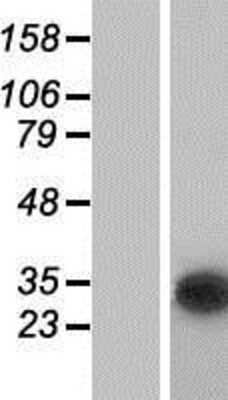 Western Blot: CUTC Overexpression Lysate [NBP2-07103]