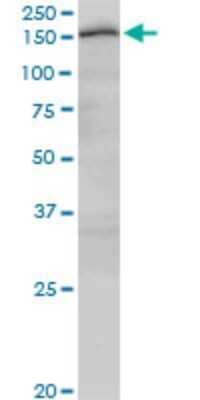 Western Blot: CUTL2 Antibody (2H8) [H00023316-M03]