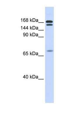Western Blot: CUTL2 Antibody [NBP1-79241]