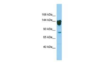 Western Blot: CUTL2 Antibody [NBP3-10599]