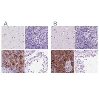 Immunohistochemistry-Paraffin: CUZD1 Antibody [NBP2-49558]