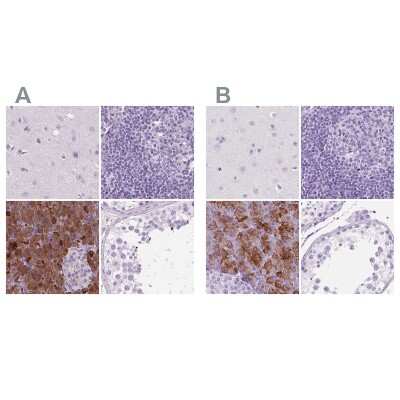Immunohistochemistry-Paraffin: CUZD1 Antibody [NBP2-49561]
