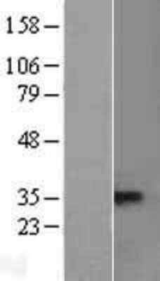 Western Blot: TACI/TNFRSF13B/CVID Overexpression Lysate [NBL1-17148]