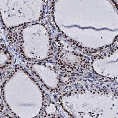 Immunohistochemistry-Paraffin: CWC15 Antibody [NBP2-31977]