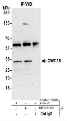 Immunoprecipitation: CWC15 Antibody [NBP2-44275]