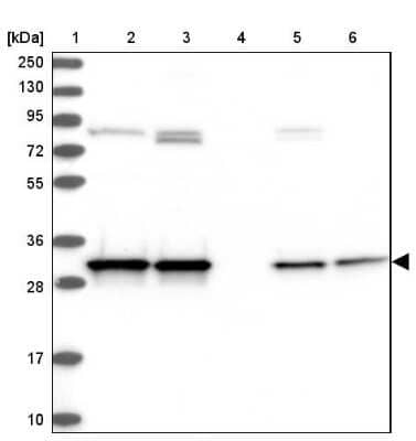 Western Blot: CWC15 Antibody [NBP2-31977]