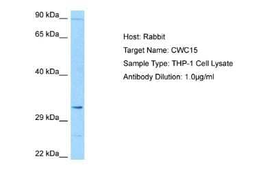 Western Blot: CWC15 Antibody [NBP2-84735]