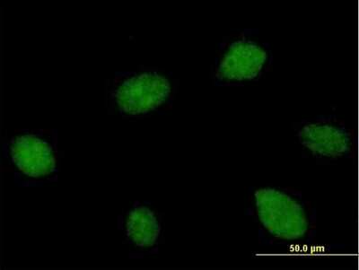 Immunocytochemistry/ Immunofluorescence: CWC22 Antibody [H00057703-B01P]
