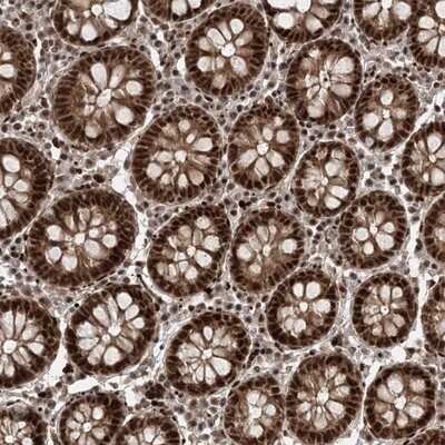 Immunohistochemistry-Paraffin: CWC22 Antibody [NBP1-84864]