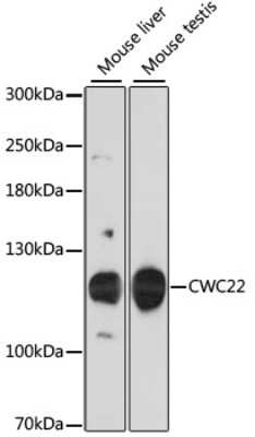 Western Blot: CWC22 AntibodyAzide and BSA Free [NBP2-92106]