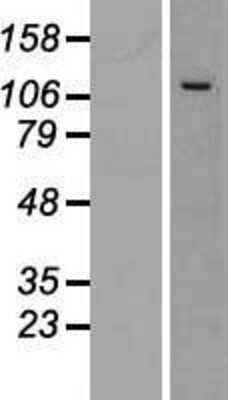 Western Blot: CWC22 Overexpression Lysate [NBL1-12271]