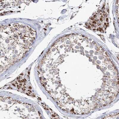 Immunohistochemistry-Paraffin: CWF19L1 Antibody [NBP1-83794]