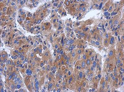 Immunohistochemistry-Paraffin: CWF19L1 Antibody [NBP2-16040]