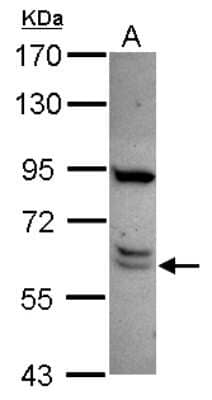 Western Blot: CWF19L1 Antibody [NBP2-16040]