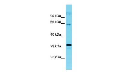 Western Blot: CWF19L1 Antibody [NBP2-87229]