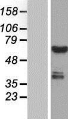 Western Blot: CWF19L1 Overexpression Lysate [NBP2-06824]