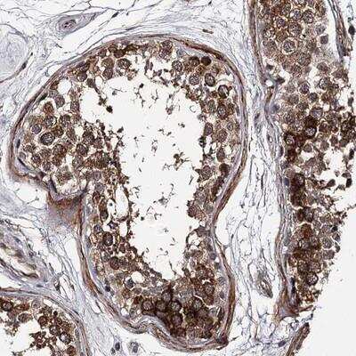 Immunohistochemistry-Paraffin: CWF19L2 Antibody [NBP1-83533]
