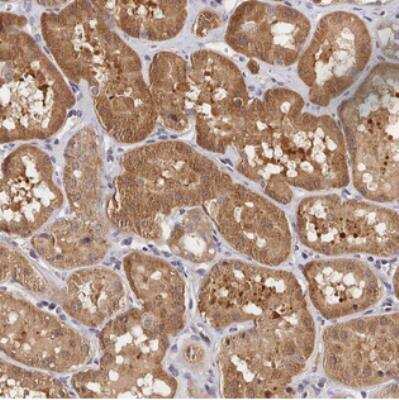 Immunohistochemistry: CWH43 Antibody [NBP2-30438]