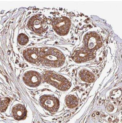 Immunohistochemistry: CWH43 Antibody [NBP2-30526]