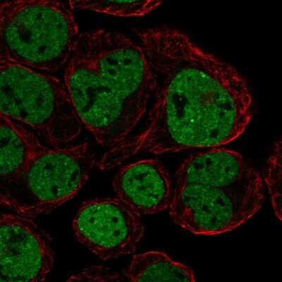 Immunocytochemistry/ Immunofluorescence: CX3CR1 Antibody [NBP2-68616]