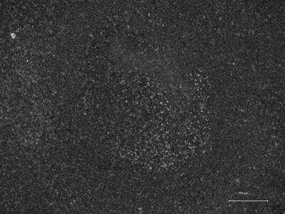 Immunohistochemistry-Paraffin: CX3CR1 Antibody - BSA Free [NBP1-76949]