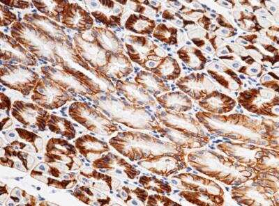 Immunohistochemistry-Paraffin: CXADR Antibody (001) [NBP2-90355]