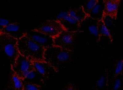 Immunocytochemistry/ Immunofluorescence: CXADR Antibody (271) [NBP2-89645]