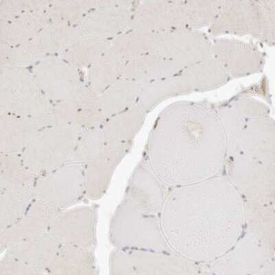 Immunohistochemistry-Paraffin: CXADR Antibody [NBP1-88192]