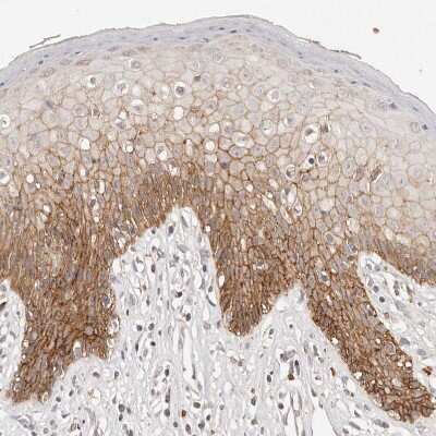 Immunohistochemistry-Paraffin: CXADR Antibody [NBP1-88192]