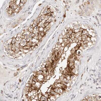 Immunohistochemistry-Paraffin: CXADR Antibody [NBP1-88192]