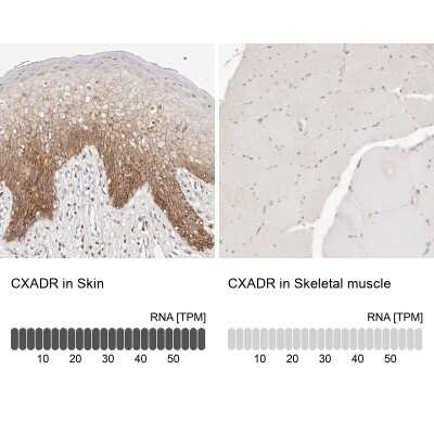 Immunohistochemistry-Paraffin: CXADR Antibody [NBP1-88192]