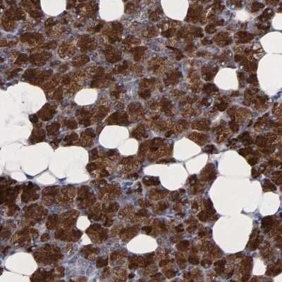 Immunohistochemistry-Paraffin: CXADR Antibody [NBP1-88193]