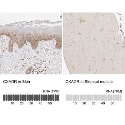 Immunohistochemistry-Paraffin: CXADR Antibody [NBP1-88194]